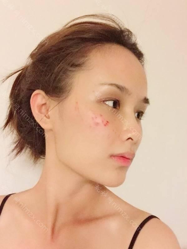 肇庆哪家医院做埋线隆鼻效果好？排行榜大全上榜牙科依次公布!含口碑及价格明细！