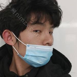 三明哪家医院做自体隆鼻效果好？2021排行前10盘点!个个都是口碑好且人气高_案例和价格同步！