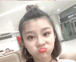 三明哪家医院做自体隆鼻效果好？2021排行前10盘点!个个都是口碑好且人气高_案例和价格同步！