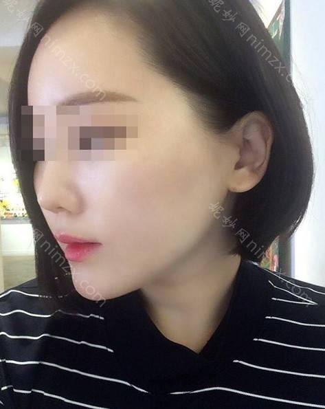 晋中哪家医院做激光溶脂瘦脸手术较好？2021排行前10盘点!个个都是口碑好且人气高_案例和价格同步！
