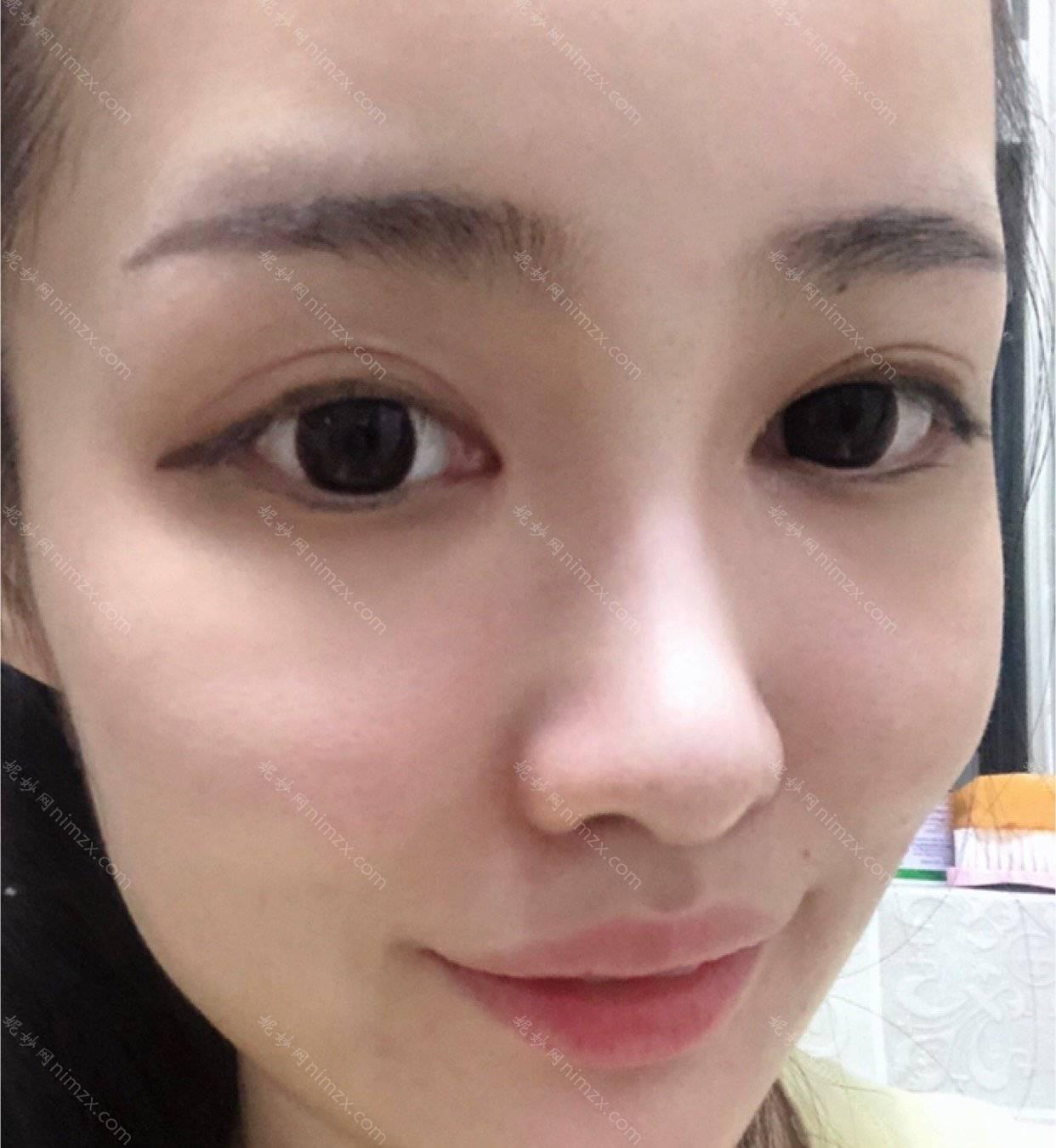 美容医院激光脱毛靠谱吗？全新案例对比图及项目价格表曝光