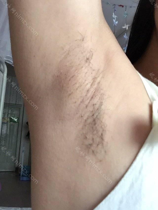 雅涵医疗美容面部脱毛怎么样？再刷专家隆鼻价格收费区间表