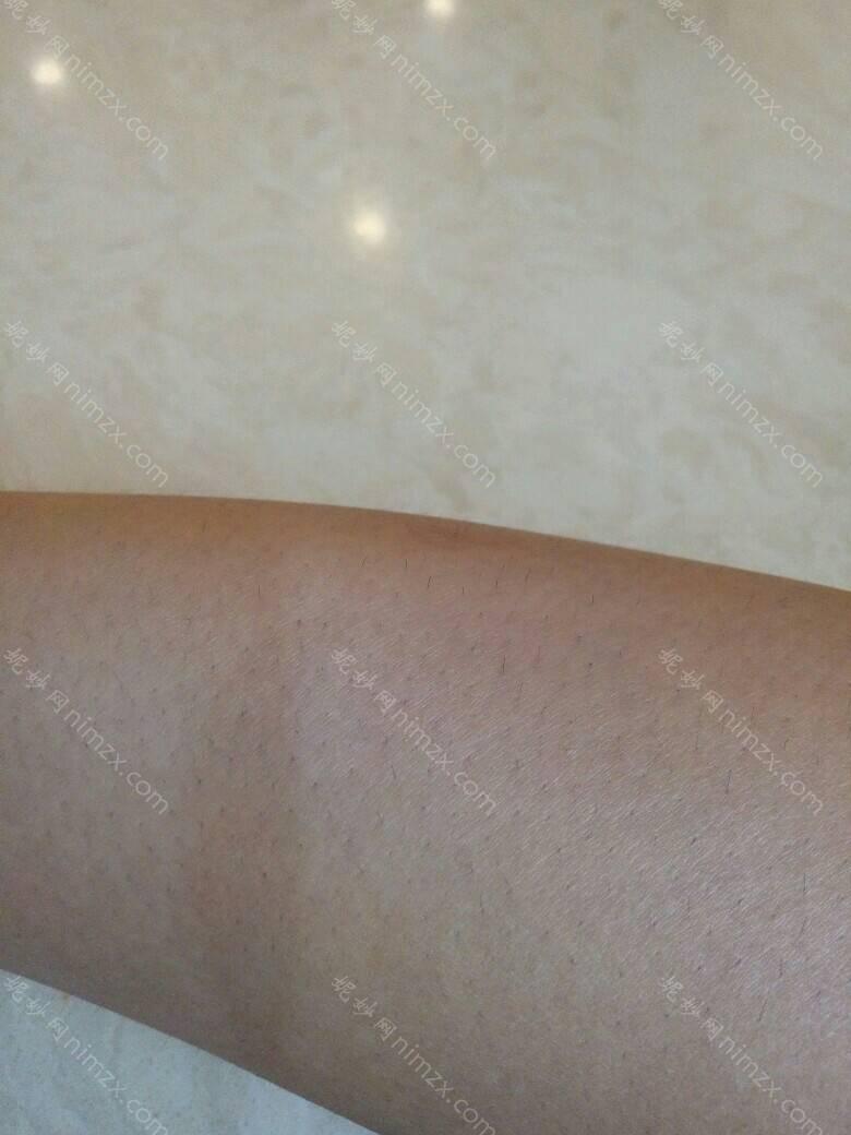深圳雅美医疗美容门诊部面部脱毛技术怎么样？还是要看授权资质、案例、价格收费这些！