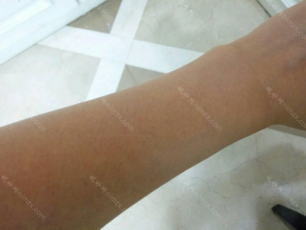 深圳雅美医疗美容门诊部面部脱毛技术怎么样？还是要看授权资质、案例、价格收费这些！
