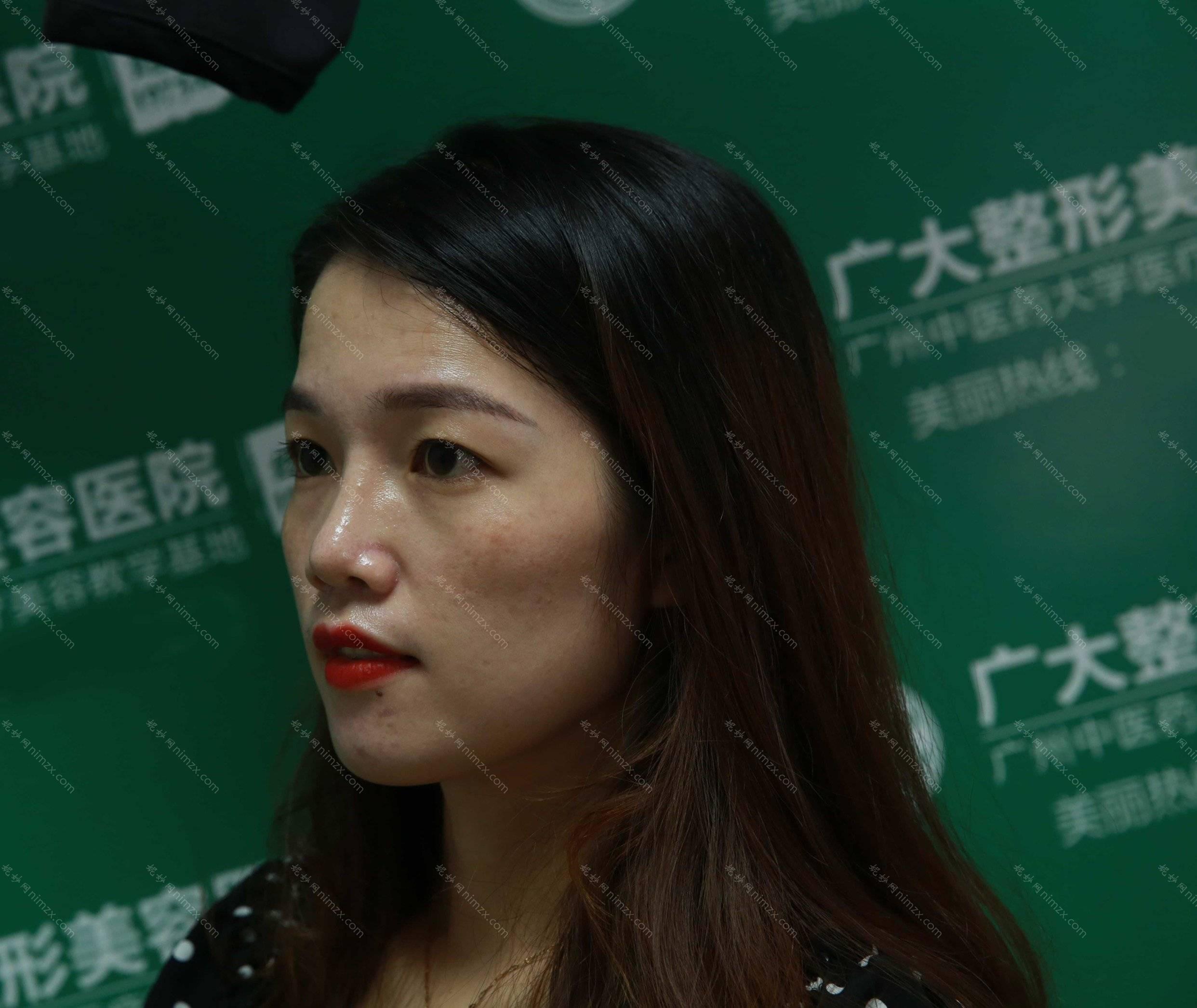 西安雁塔朱荣博医疗美容诊所朱荣博做正颌手术怎么样？附医生简介|正颌手术案例及价格表