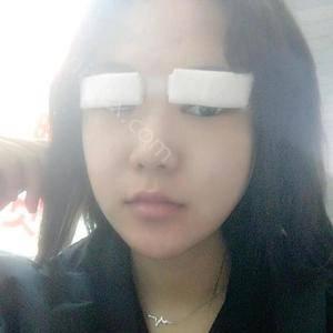 金昌姜医生整形医疗美容诊所姜春仁做韩式双眼皮整形手术怎么样？附医生简介|韩式双眼皮整形手术案例及价格表