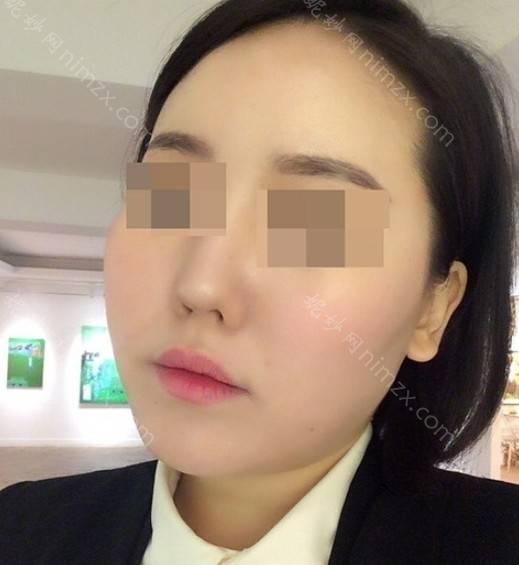 晋中哪家医院做激光溶脂瘦脸手术较好？2021排行前10盘点!个个都是口碑好且人气高_案例和价格同步！