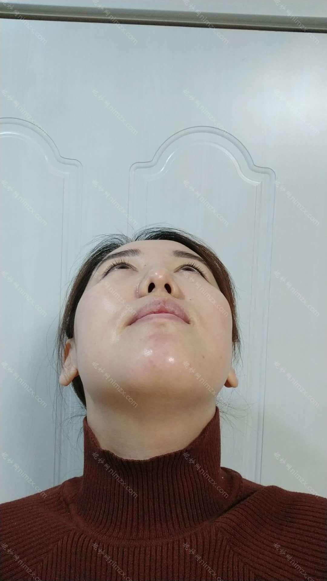华美整形脱毛口碑怎么样？医院案例和价格表可以借鉴！