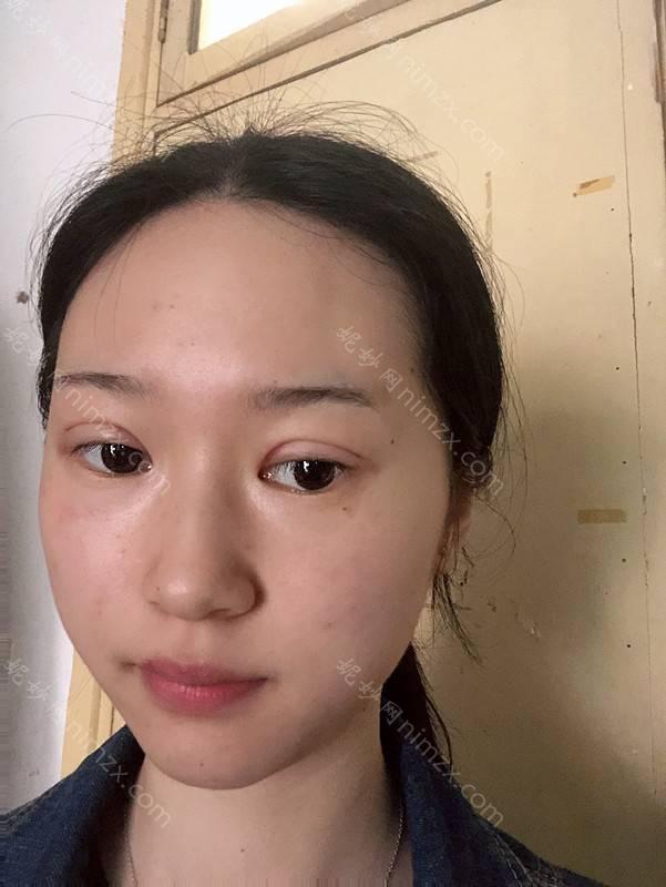 西安碧莲盛植发瘦脸*靠谱吗？结合案例及价格收费来深入了解！