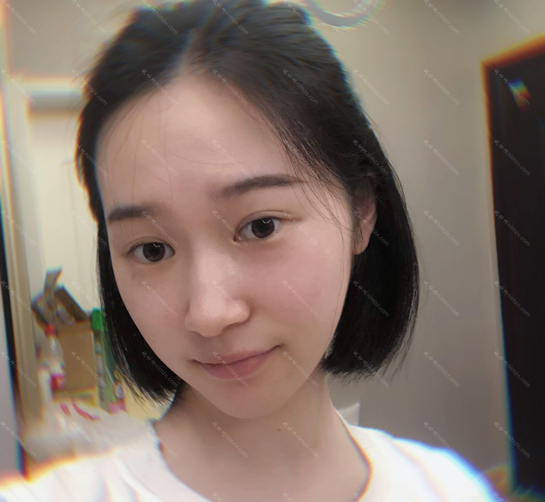 西安碧莲盛植发瘦脸*靠谱吗？结合案例及价格收费来深入了解！