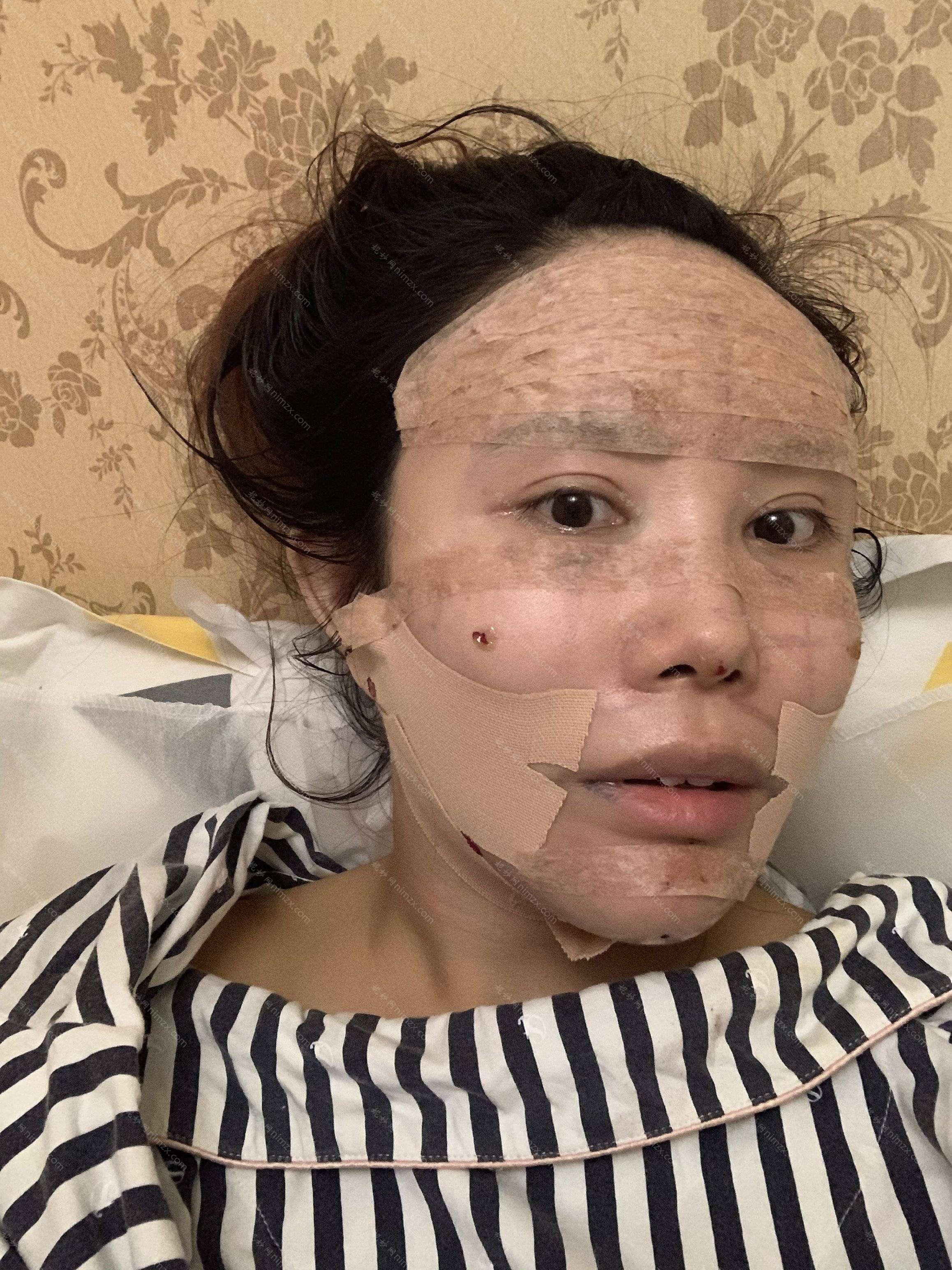 北京韩啸医疗美容正规的吗?附2022年较新价格表