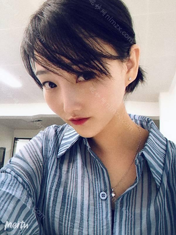 脱毛做得怎么样？手术恢复效果图一览