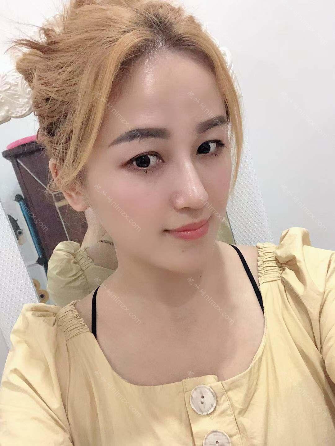 曲靖哪家医院做膨体隆鼻好？排名前四权威医美口碑盘点_含手术价格查询！