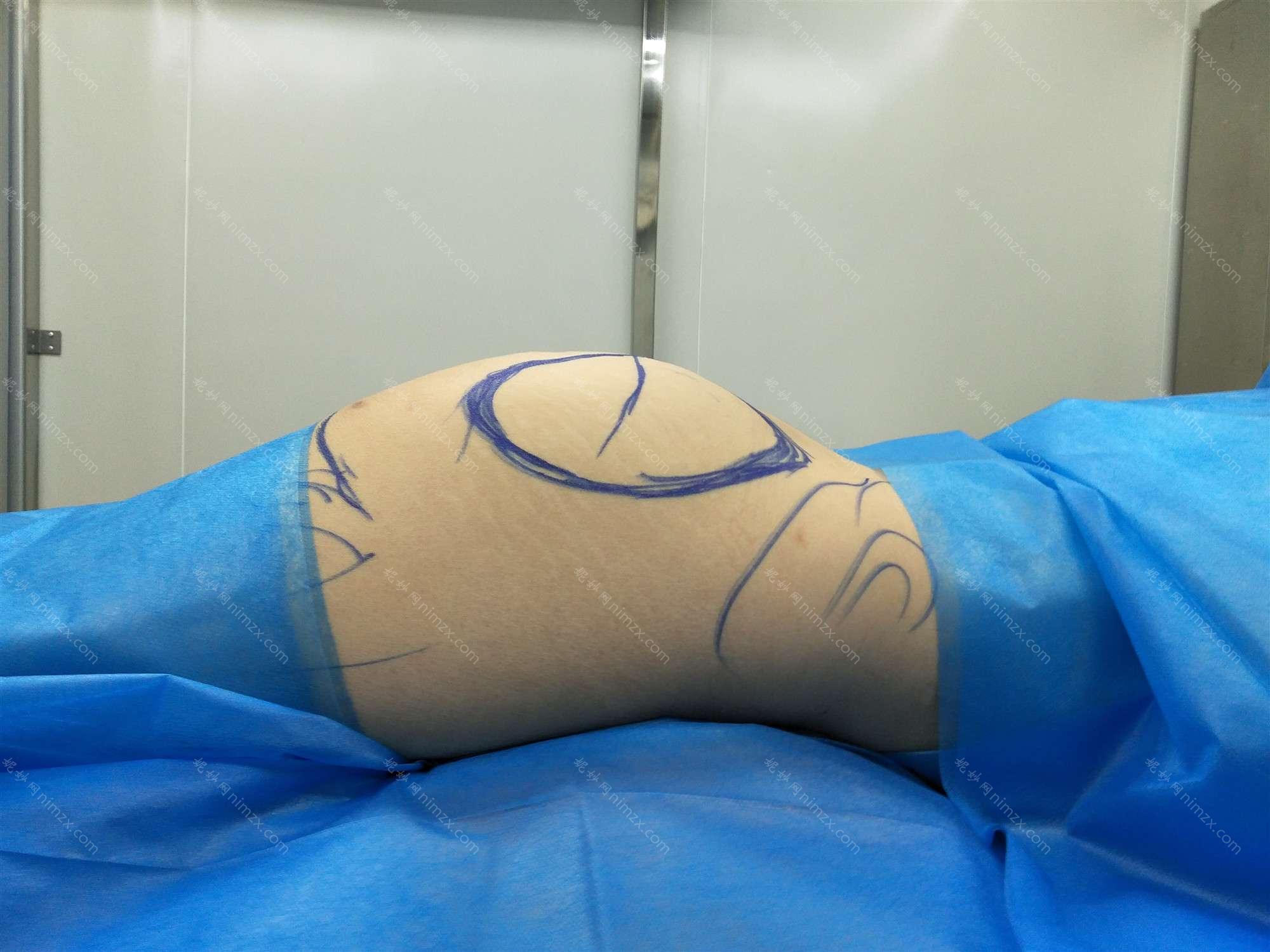 邢台哪家医院做复合隆胸手术较好？10强医院口碑特色各不同~价格收费合理！