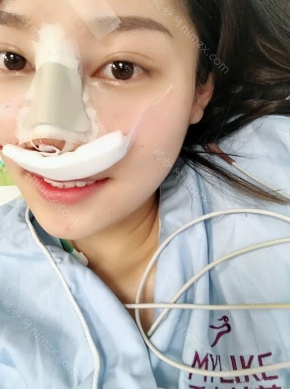 曲靖哪家医院做膨体隆鼻好？排名前四权威医美口碑盘点_含手术价格查询！
