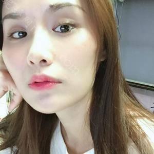 常州激光医院整形美容中心余力做激光祛眼袋怎么样？附医生简介|激光祛眼袋案例及价格表