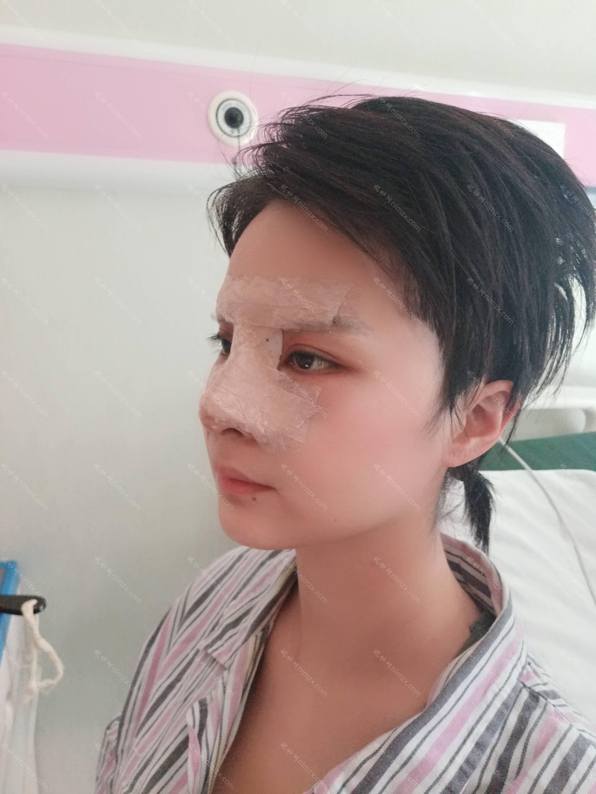 三明哪家医院做隆鼻术比较好？全国排名前五医院来对比!价格(多少钱)参考！