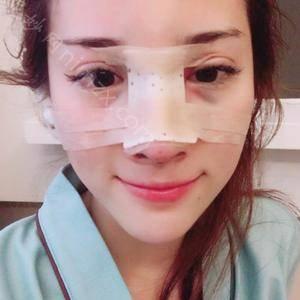 通化哪家医院做鼻中隔软骨隆鼻好看？汇总一份口碑医院排行榜前五点评!价格表全新查询！