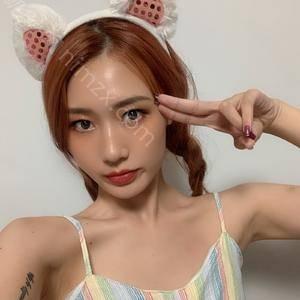 聊城烧伤整形与医学美容门诊赵票威 做自体耳软骨隆鼻怎么样？附医生简介|自体耳软骨隆鼻案例及价格表