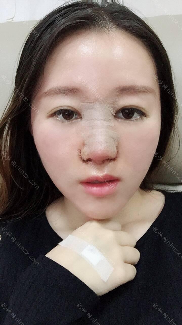 孝感哪家医院做耳软骨垫鼻尖好看？排行榜医院齐聚_孝感仁爱医院、华美等一一公布口碑!！