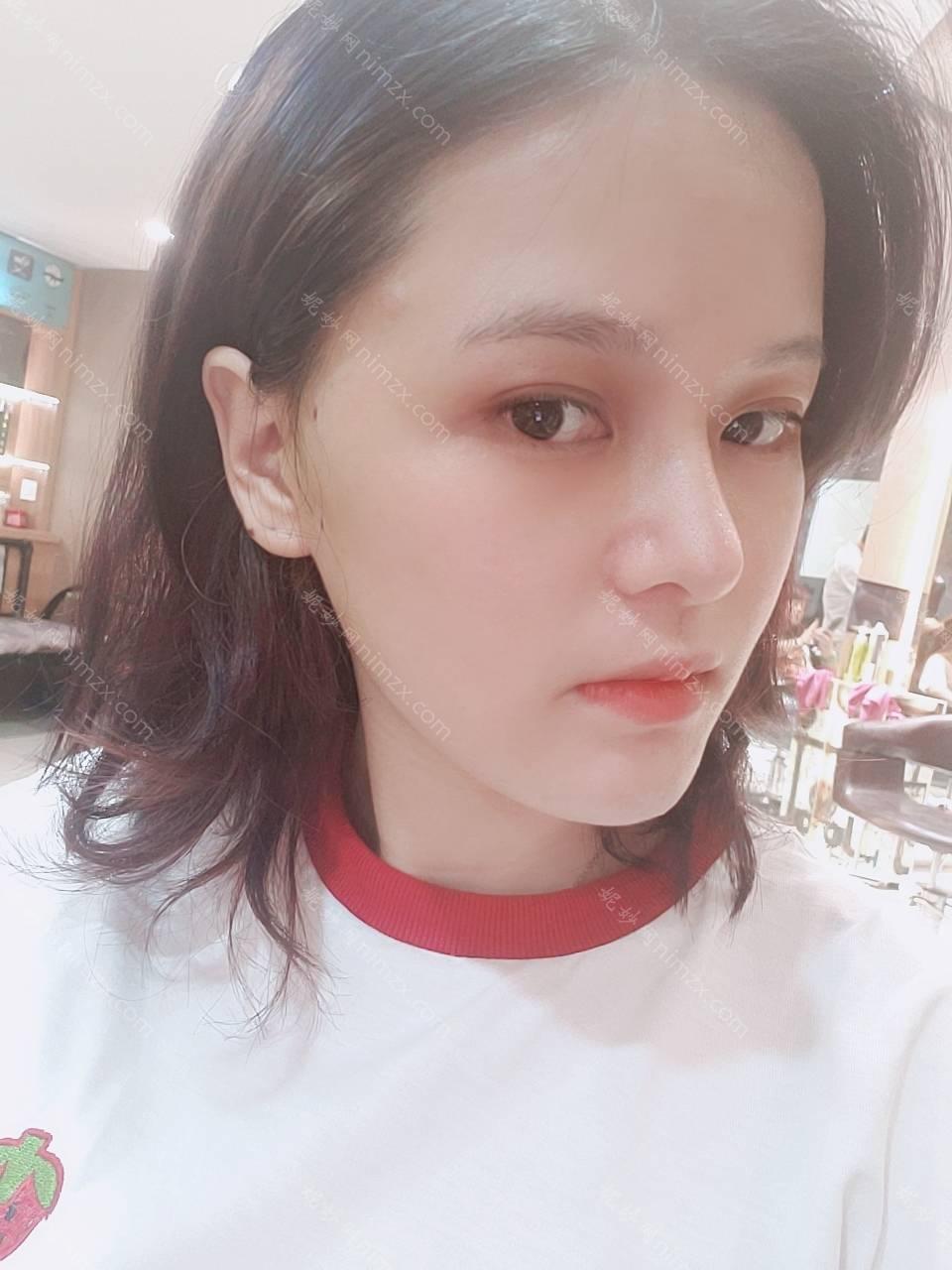 孝感哪家医院做耳软骨垫鼻尖好看？排行榜医院齐聚_孝感仁爱医院、华美等一一公布口碑!！