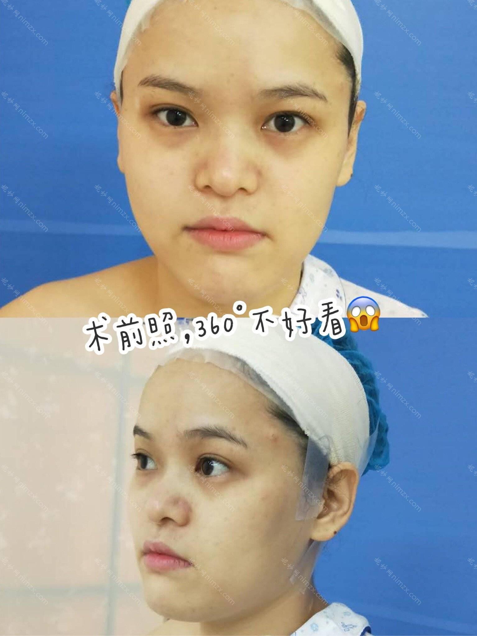 孝感哪家医院做耳软骨垫鼻尖好看？排行榜医院齐聚_孝感仁爱医院、华美等一一公布口碑!！