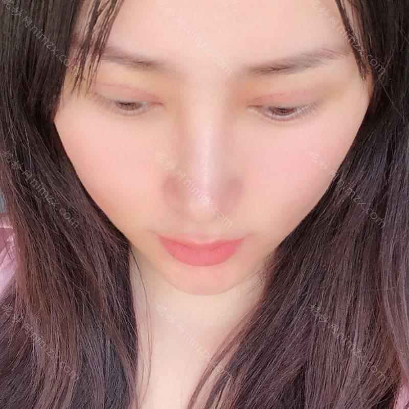 十堰哪家医院做欧式双眼皮正规？正规排名榜盘点前四_价格清单一一出示!！