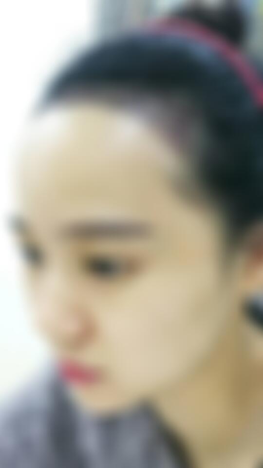 保定蓝山医疗美容医院整形医院价格,附2022较新整形案例