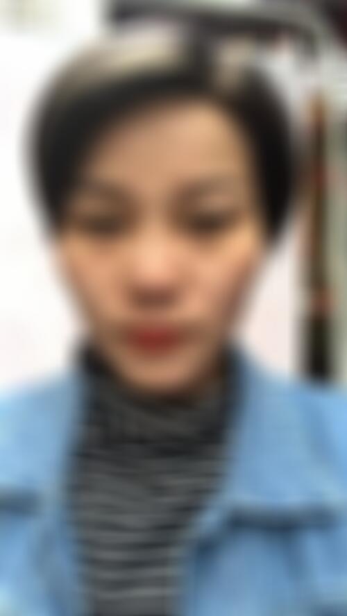 昆明艺星医疗美容医院整形医院怎么样,附2022年较新价格表