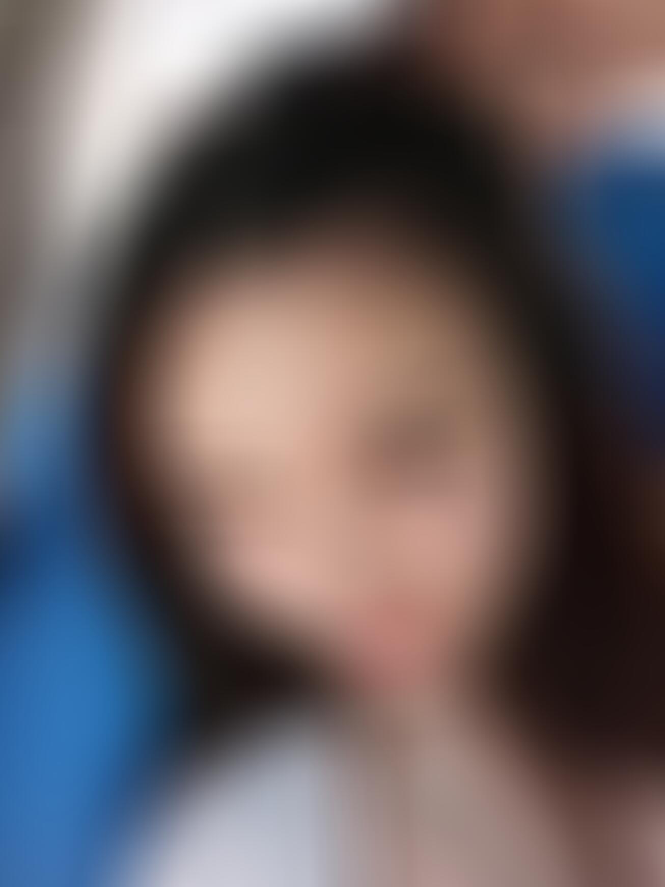 成都美绽美整形美容医院整形医院价格