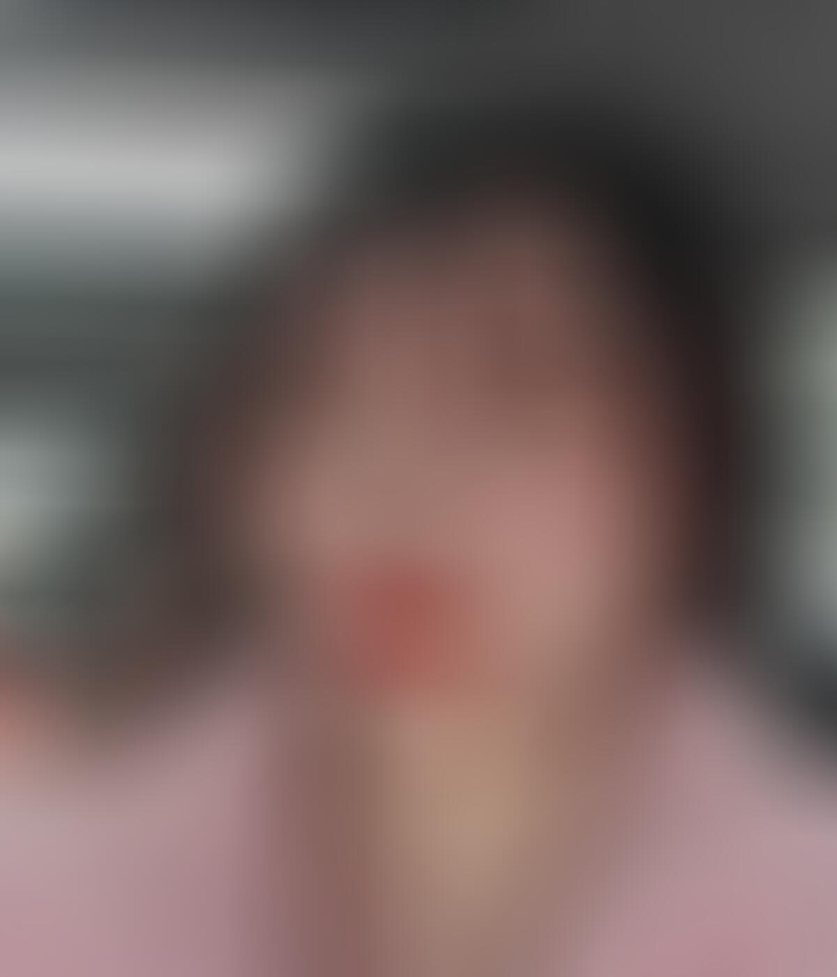 上海伯思立医疗美容门诊部整形医院口碑好吗,附2022较新整形案例