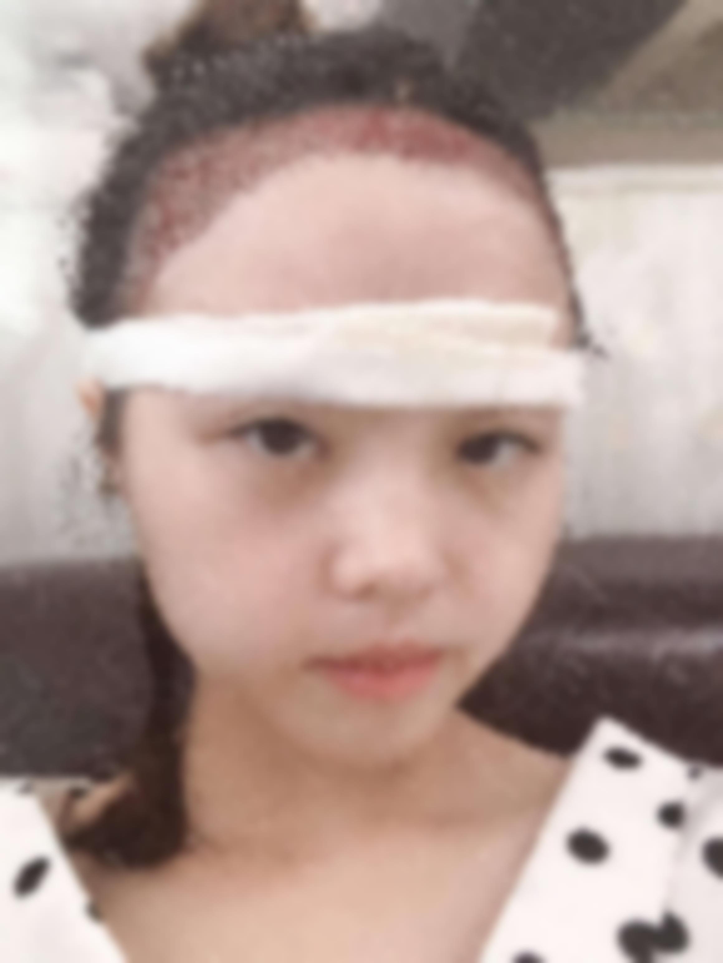 北京凯润婷医疗美容医院崔克明怎么样