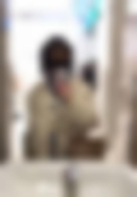「淮安新生植发」怎么样?正规吗|案例|价格表