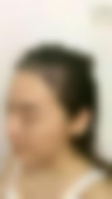 北京画美医院赵宏伟怎么样