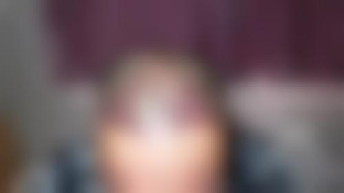 「西安美立方整形医院植发中心」怎么样?正规吗|案例|价格表