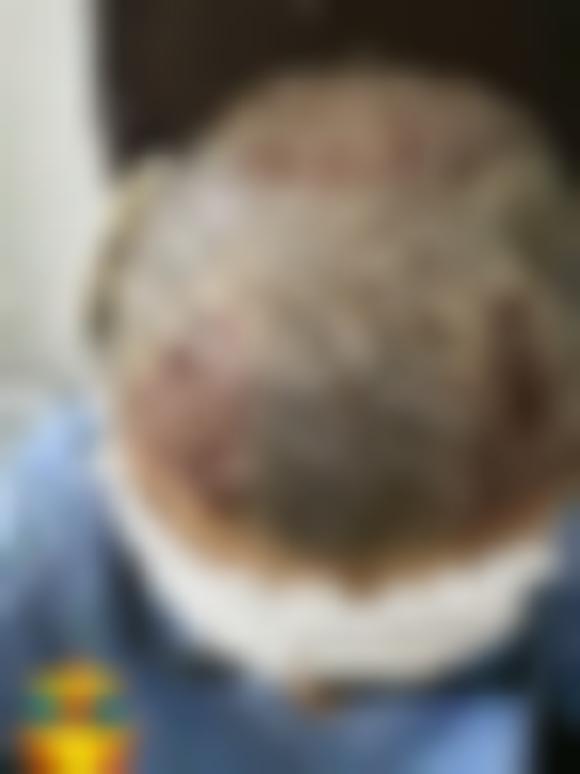 「泉州美莱整形」怎么样?正规吗|案例|价格表