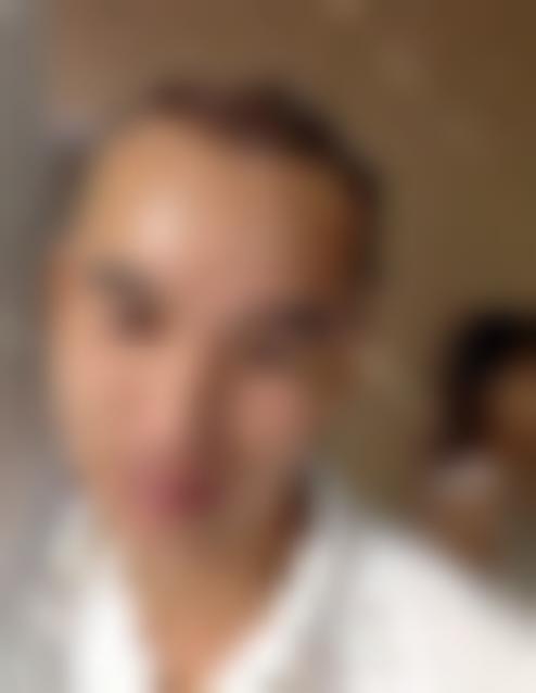 「昆明云南华美美莱美容医院」怎么样?正规吗|案例|价格表