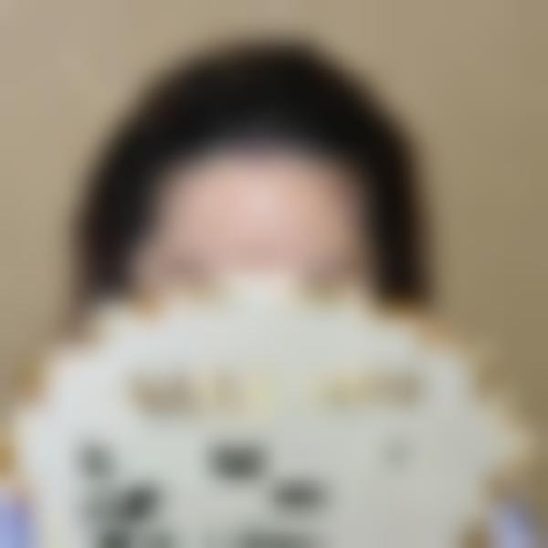「南京新生植发」怎么样?正规吗|案例|价格表