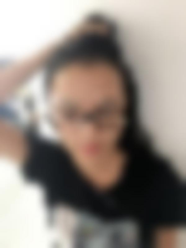 「北京同仁医院植发科」怎么样?正规吗|案例|价格表