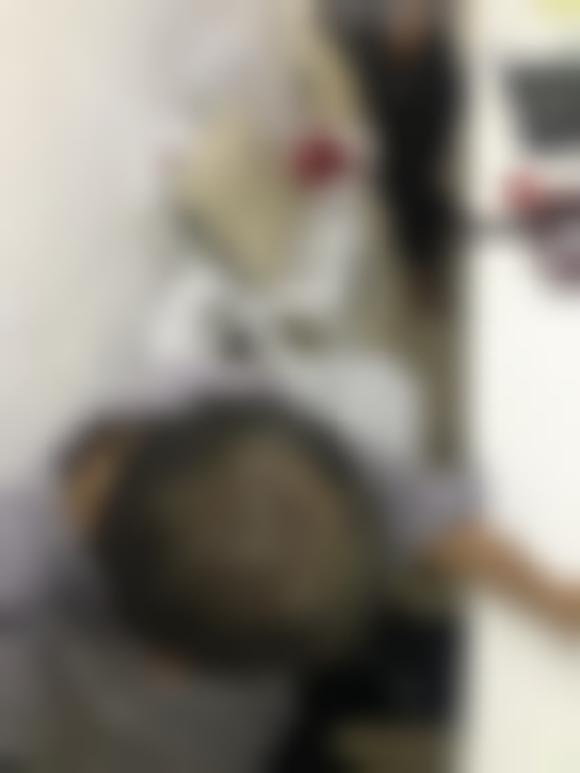 「北京协和医院植发中心」怎么样?正规吗|案例|价格表