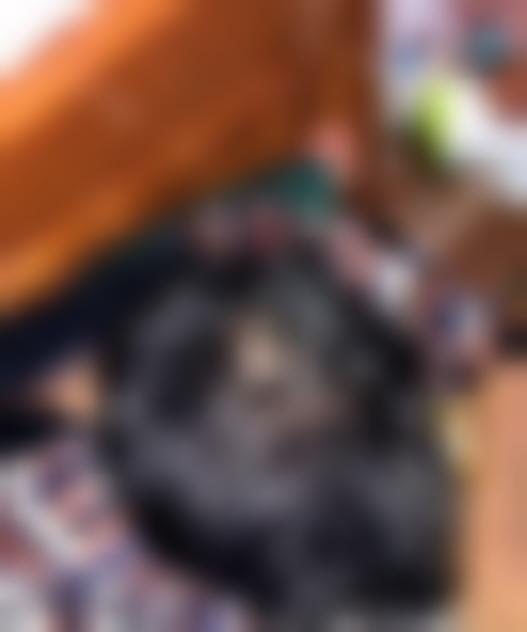 「北京协和医院植发中心」怎么样?正规吗|案例|价格表
