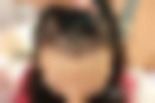 「广州瑞丽诗植发医院」怎么样?正规吗|案例|价格表