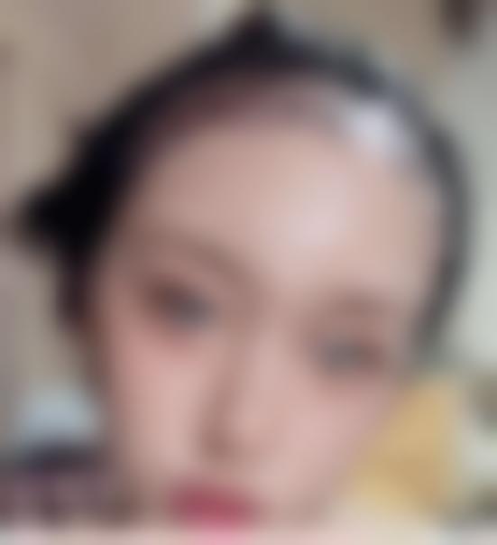 「南京瑞丽诗医疗美容诊所」怎么样?正规吗|案例|价格表