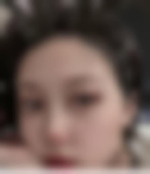 「南京瑞丽诗医疗美容诊所」怎么样?正规吗|案例|价格表