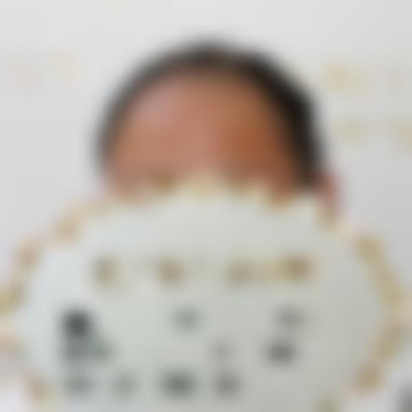 「扬州新生植发」怎么样?正规吗|案例|价格表