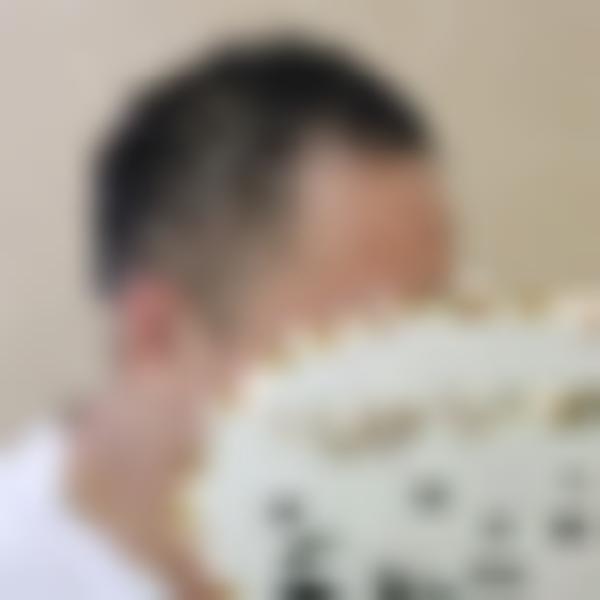 「扬州新生植发」怎么样?正规吗|案例|价格表