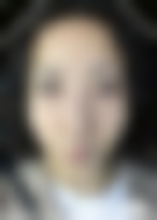 「上海伊尔美港华医疗美容医院」怎么样?正规吗|案例|价格表