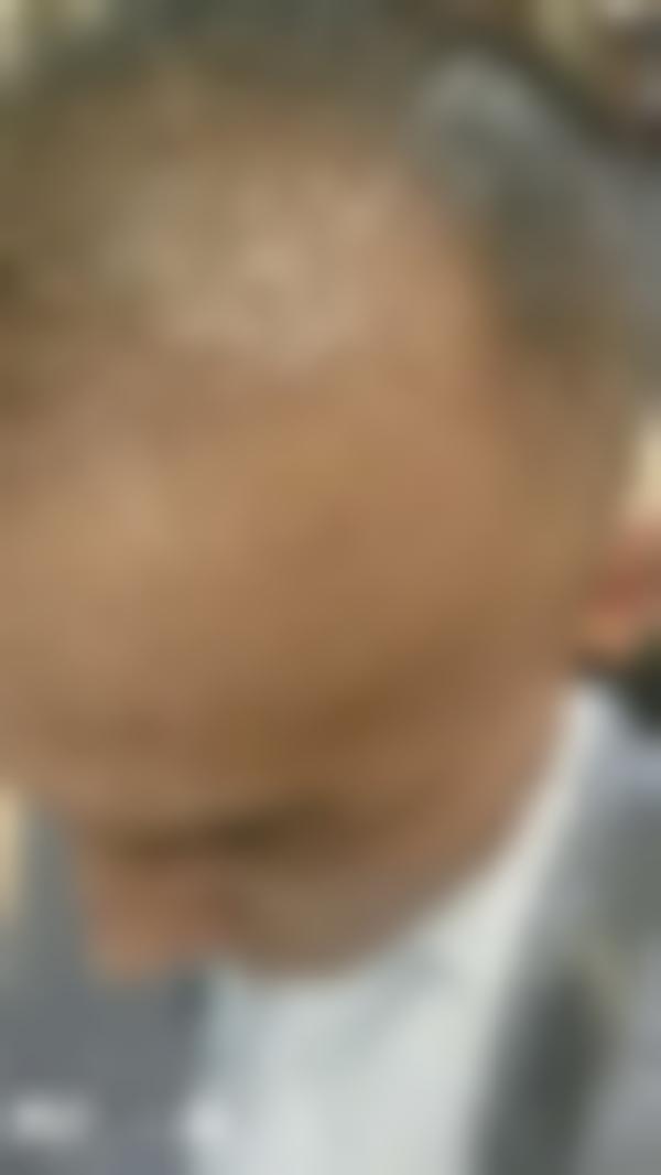 「成都锦江童颜博仕医学祛斑门诊部」怎么样?正规吗|案例|价格表