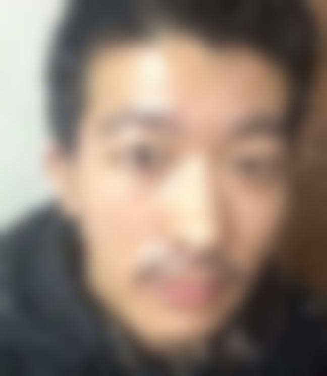 「东莞新生植发」怎么样?正规吗|案例|价格表