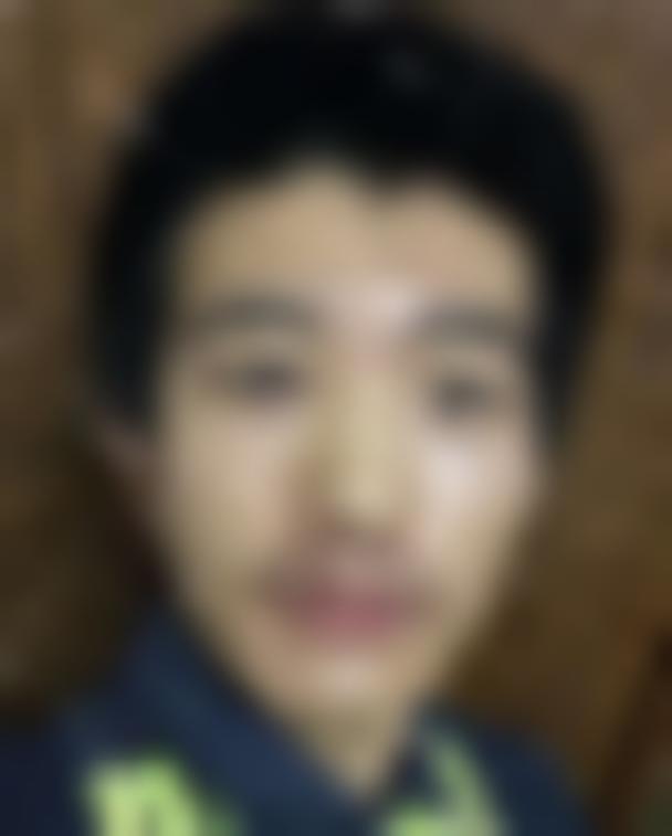 「东莞新生植发」怎么样?正规吗|案例|价格表